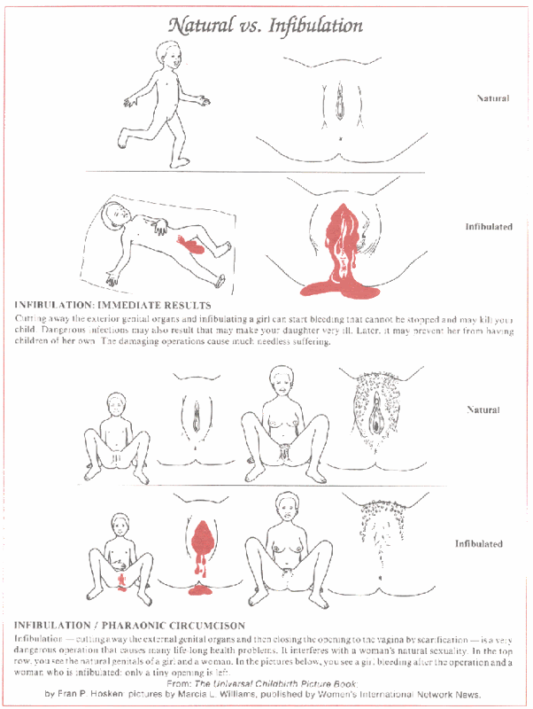 fig2.gif