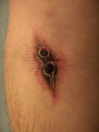 Vampire bite. Purple Demon Vampire bite. Purple Demon