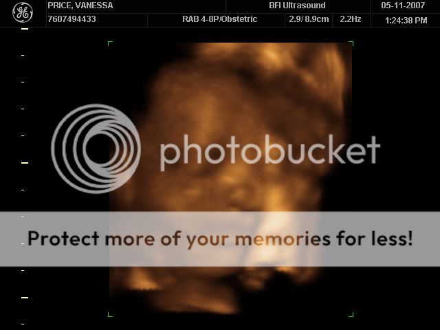 4d ultrasound video 26 weeks